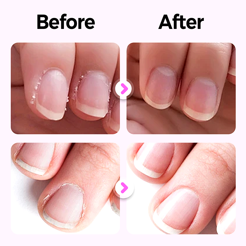💜2025 New Upgraded 3-in-1 Nail Care Pen💅